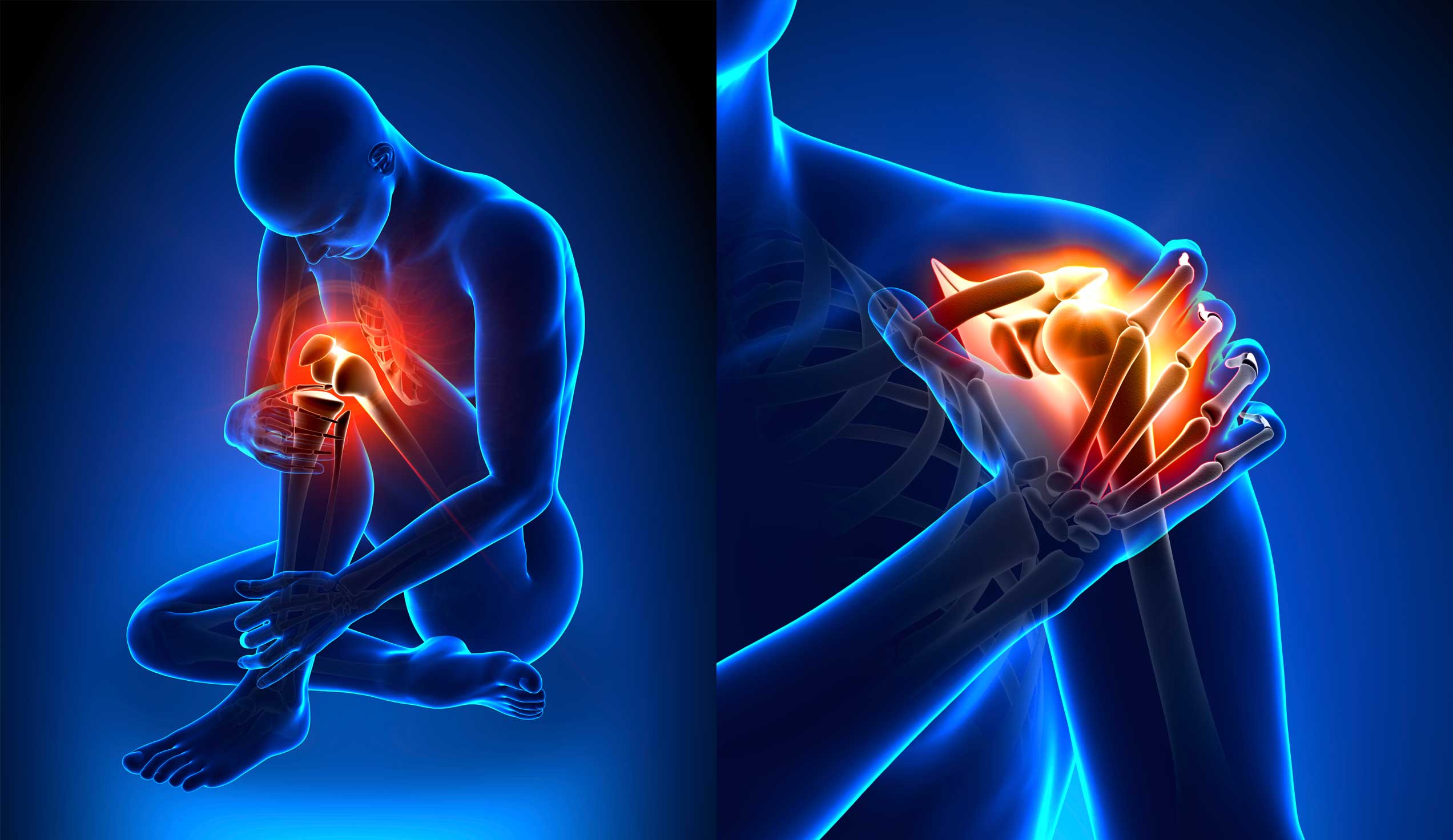 natural painkillers, pain killer, inflammation